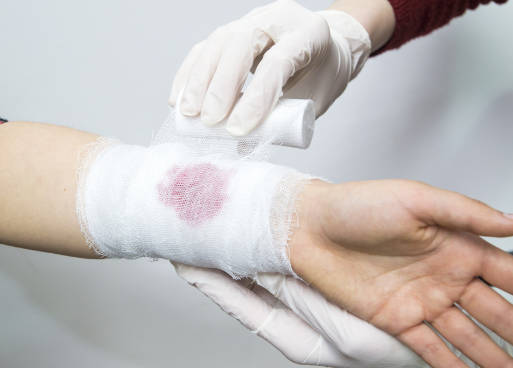 Como estacar sangramento? Saiba a técnica de sobrevivência